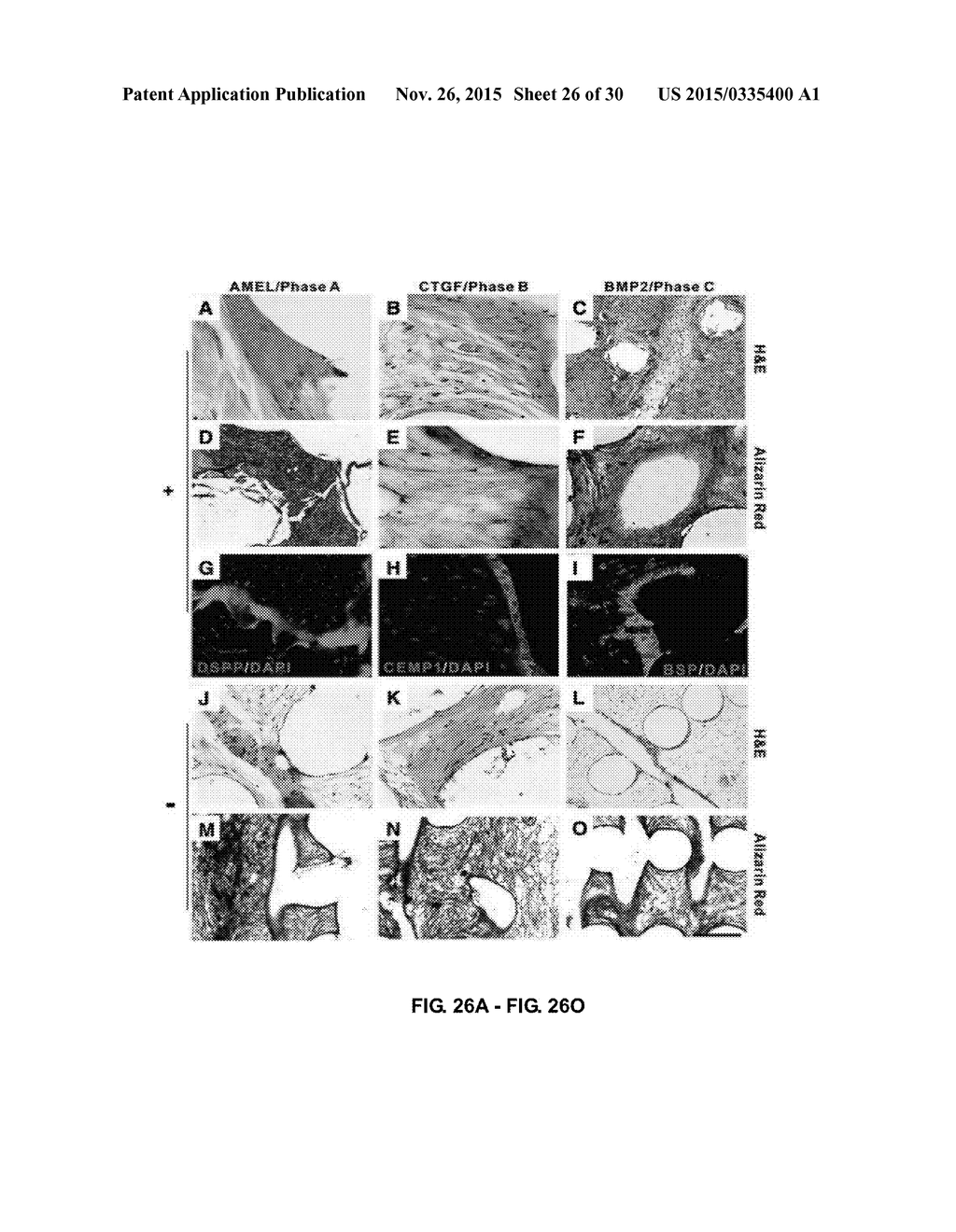 TOOTH SCAFFOLDS - diagram, schematic, and image 27