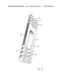 Intermediate Body for a Bone Implant, and Implant Arrangement diagram and image