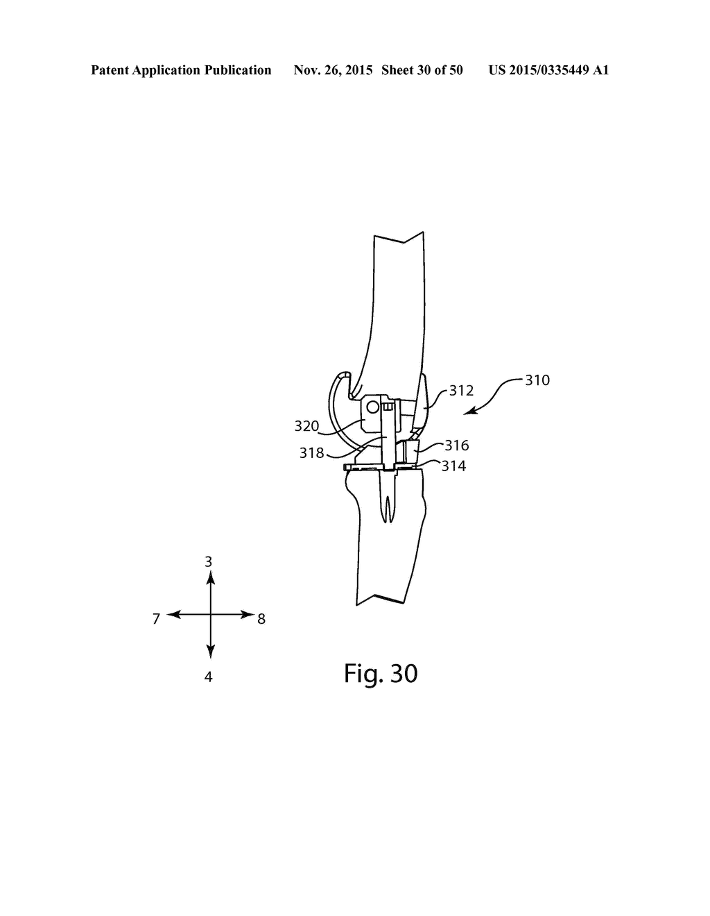 SYSTEMS AND METHODS FOR MOBILE BEARING PROSTHETIC KNEE - diagram, schematic, and image 31