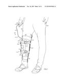 ADJUSTABLE LEG BRACE SYSTEMS AND METHODS diagram and image