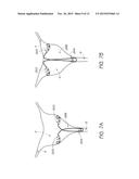 INTRAUTERINE CONTRACEPTIVE DEVICE diagram and image