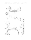 INTRAUTERINE CONTRACEPTIVE DEVICE diagram and image