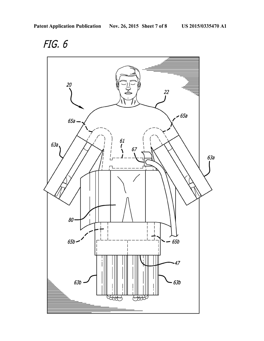 PATIENT WARMING GOWN WITH PERIPHERAL WARMING - diagram, schematic, and image 08