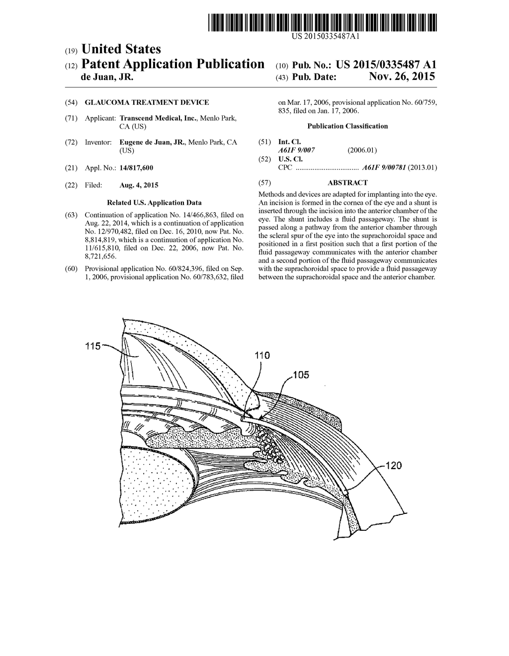 Glaucoma Treatment Device - diagram, schematic, and image 01