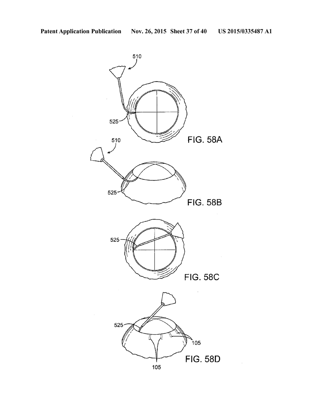 Glaucoma Treatment Device - diagram, schematic, and image 38