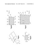 METHOD AND APPARATUS FOR CORRECTING AURICULAR DEFORMITIES diagram and image