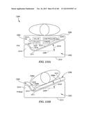 SYSTEMS, METHODS, AND DEVICES FOR TREATMENT OF SLEEP DISORDERS diagram and image