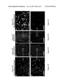 METHODS AND COMPOSITIONS FOR TREATING HUNTINGTON S DISEASE diagram and image