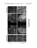 METHODS AND COMPOSITIONS FOR TREATING HUNTINGTON S DISEASE diagram and image