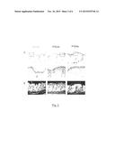 USE OF A PHOTOSENSITIVE AGENT CAPABLE OF PRODUCING REACTIVE OXYGEN SPECIES     IN THE PRODUCTION OF A DRUG FOR THE  PHOTODYNAMIC THERAPY OF A DISEASE     RELATED TO STEM CELLS, IN VITRO USE, AND PHARMACEUTICAL COMPOSITION diagram and image