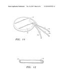 Extracellular Matrix Encasement Structures and Methods diagram and image