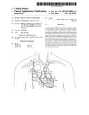 HEART ASSIST SYSTEM AND METHODS diagram and image