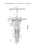 HEART ASSIST SYSTEM AND METHODS diagram and image