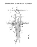 HEART ASSIST SYSTEM AND METHODS diagram and image