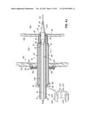 HEART ASSIST SYSTEM AND METHODS diagram and image