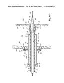 HEART ASSIST SYSTEM AND METHODS diagram and image