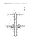 HEART ASSIST SYSTEM AND METHODS diagram and image