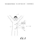 CONNECTION AND ALIGNMENT SYSTEMS AND METHODS diagram and image