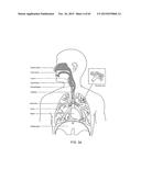 PATIENT INTERFACE diagram and image