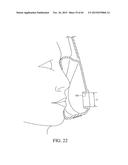 PATIENT INTERFACE diagram and image