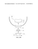 PATIENT INTERFACE diagram and image