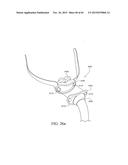 PATIENT INTERFACE diagram and image