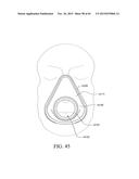 PATIENT INTERFACE diagram and image