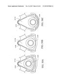 PATIENT INTERFACE diagram and image