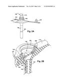 Interlock Feed Set Coupling diagram and image