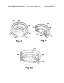 Interlock Feed Set Coupling diagram and image