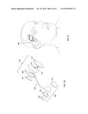 CANTILEVER ELECTRODES FOR TRANSDERMAL AND TRANSCRANIAL STIMULATION diagram and image