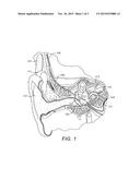 Impact Protection for Implantable Electric Lead diagram and image