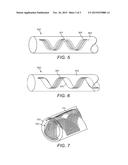 Impact Protection for Implantable Electric Lead diagram and image