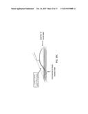 TRANSDERMAL NEUROSTIMULATOR ADAPTED TO REDUCE CAPACITIVE BUILD-UP diagram and image