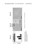 SPLENIC IRRADIATION FOR THE TREATMENT OF NEUROLOGICAL DISORDERS diagram and image