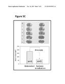 SPLENIC IRRADIATION FOR THE TREATMENT OF NEUROLOGICAL DISORDERS diagram and image