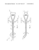 Golf Buggy Steering System diagram and image