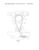 Mooring Device diagram and image