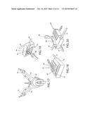 Mooring Device diagram and image