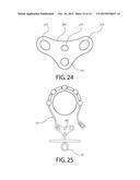 Mooring Device diagram and image