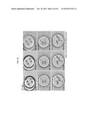 RAPID ANTIBIOTIC SUSCEPTIBILITY TESTING SYSTEM BASED ON BACTERIAL     IMMOBILIZATION USING GELLING AGENT, ANTIBIOTIC DIFFUSION AND TRACKING OF     SINGLE BACTERIAL CELLS diagram and image