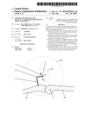 METHOD AND APPARATUS FOR DETECTING UNDESIRABLE ROTATION OF MEDICAL MARKERS diagram and image