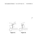 METHOD AND APPARATUS FOR DETECTING UNDESIRABLE ROTATION OF MEDICAL MARKERS diagram and image