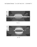 AN ACTIVE TRACKING SYSTEM AND METHOD FOR MRI diagram and image