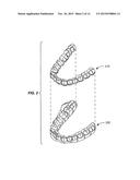 SYSTEMS AND METHODS FOR TRACKING TEETH MOVEMENT DURING ORTHODONTIC     TREATMENT diagram and image