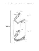 SYSTEMS AND METHODS FOR TRACKING TEETH MOVEMENT DURING ORTHODONTIC     TREATMENT diagram and image