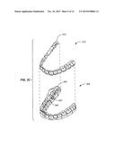 SYSTEMS AND METHODS FOR TRACKING TEETH MOVEMENT DURING ORTHODONTIC     TREATMENT diagram and image