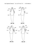 SYSTEMS AND METHODS FOR TRACKING TEETH MOVEMENT DURING ORTHODONTIC     TREATMENT diagram and image