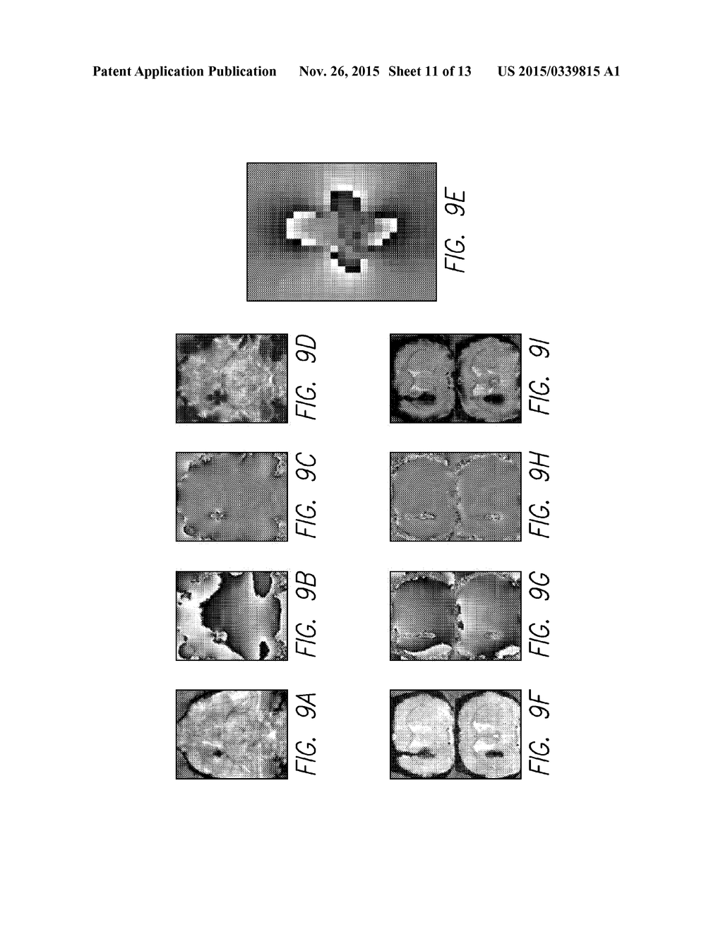 IRON QUANTIFICATION OF BRAIN MICROBLEEDS - diagram, schematic, and image 12