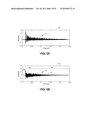 METHODS AND DEVICES FOR REVERBERATION SUPPRESSION diagram and image